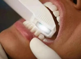 Scansione ad arco rispetto ai metodi di scansione tradizionali: quale è migli...
